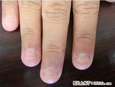 剪指甲、挖耳屎，这些日常小动作竟隐藏大危害！ - 大同生活资讯 - 大同28生活网 dt.28life.net